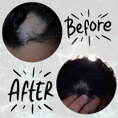 Bộ dầu gội xả CHI Power Plus – Ngăn rụng & Kích thích mọc tóc (CHI Power Plus Hair Renewing)