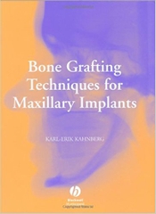Sách Bone Grafting Techniques for Maxillary Implants - Wiley-Blackwell_ 1 edition