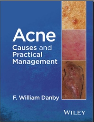 Sách acne: causes and practical management