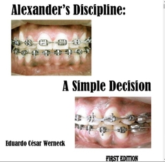 Sách Alexanders Discipline- A Simple Decision - I.E.P.C. Publishing House _ 1 edition