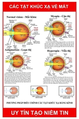 Tranh treo các tật khúc xạ về mắt ( Kích thước ngang 50 cm. Cao 75 cm)