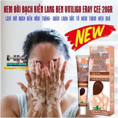 KEM BÔI BẠCH BIẾN LANG BEN VITILIGO ERAY CEE-20GR LÀM MỜ BẠCH BIẾN ĐỐM TRẮNG NÁM THÂM HIỆU QUẢ