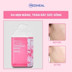 Mặt nạ Mediheal Pepta Lifting Ampoule Mask (hồng)