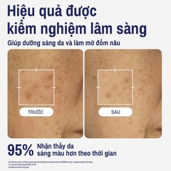 Tinh Chất Làm Sáng Da Cetaphil Bright Healthy Radiance Perfecting Serum 30ml