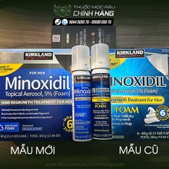 minoxidil dạng bọt