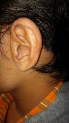 people-use-iic-hearing-aid