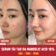 Serum tái tạo da Dr.Wu Intensive Renewal Serum With Mandelic Acid 18% 15ML