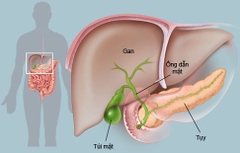 6 dấu hiệu đã đến lúc bạn cần thải độc gan