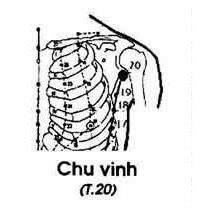 Chu Vinh