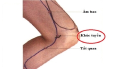 Huyệt khúc tuyền chủ trị khớp gối, viêm khớp gối