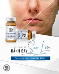 Tế bào gốc làm đầy sẹo rỗ, sẹo lõm NuEssential Serum Scar Control 5ml