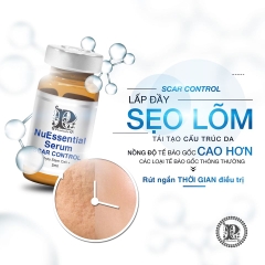 Tế bào gốc làm đầy sẹo rỗ, sẹo lõm NuEssential Serum Scar Control 5ml