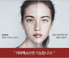 Kem Trị Thâm Nám Melasma-x 3D Whitening Clinic Cream