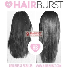 Hairburst - Viên uống hỗ trợ mọc tóc của Anh