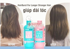 Bộ dầu gội HairBurst For Longer Stronger Hair