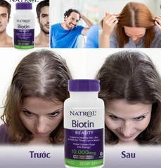 Viên uống mọc tóc Biotin Natrol 10000mcg