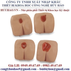 MÔ HÌNH THỰC HÀNH CHĂM SÓC VẾT LOÉT LF00934 NASCO