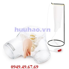 Mô hình thông tiểu nam 3B 1017241