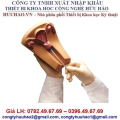 MÔ HÌNH THỰC HÀNH ĐẶT VÒNG TRÁNH THAI