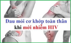 Dấu hiệu đau mỏi cơ khớp khi mới nhiễm HIV như thế nào?