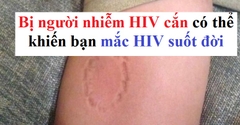 Bị người nhiễm HIV cắn có bị lây HIV không?