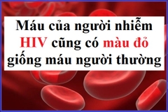 Máu của người nhiễm HIV có màu gì?