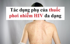 Tác dụng phụ của thuốc phơi nhiễm HIV là gì?