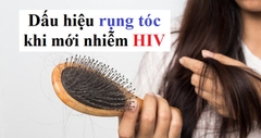 Dấu hiệu rụng tóc khi mới nhiễm HIV như thế nào?