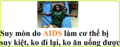 Hội chứng suy mòn AIDS là gì?