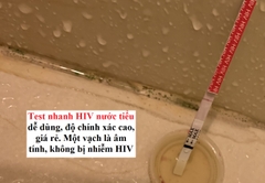 Muốn test nhanh HIV tại nhà làm thế nào? Có đau không?