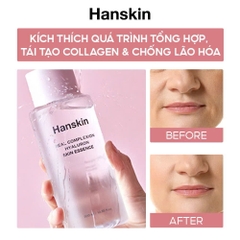 Nước Hoa Hồng Dưỡng Ẩm HANSKIN REAL COMPLEXION HYALURON SKIN ESSENCE 300ml
