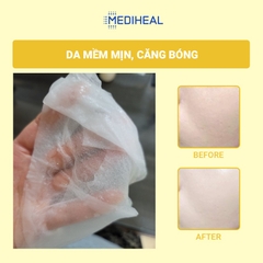 Mặt Nạ Mediheal Vita Toning Essence Mask Cấp ẩm Dưỡng Trắng 20ml