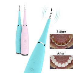 Dụng cụ lấy vôi răng và các vết ố trên răng Uniharpa Household Electric Dental Calculus Remover