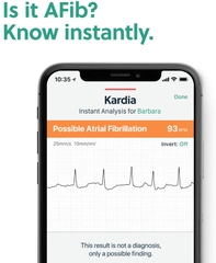 Máy đo điện tâm đồ và nhịp tim mini - Alivecor Kardia Mobile ECG