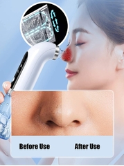 Dụng cụ làm đẹp mini sử dụng pin sạc Super micro bubble beauty instrument