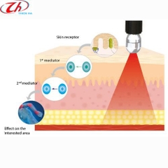 THIẾT BỊ LASER TRỊ LIỆU WINLASE JOHARI