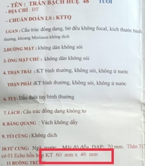 Bách Phụ Vương 40 Viên Hỗ Trợ Điều Trị U Xơ Tử Cung, U Xơ Tuyến Vú, U Xơ Tiền Liệt Tuyến, Giảm Sự Phát Triển của U Xơ Tử Cung, U Xơ Tuyến Vú, U Xơ Tuyến Tiền Liệt, Phì Đại Lành Tính Tiền Liệt Tuyến Phan An Green Nine's Beauty