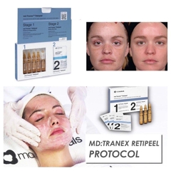 Peel Da Md:Ceuticals Md Tranex Retipeel [Chính Hãng]