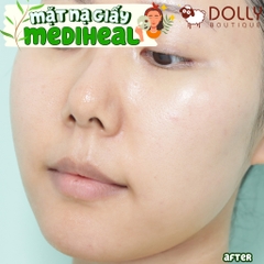 Mặt Nạ Miếng Mediheal Teatree Essential Mask 25ml