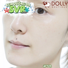 Kem Dưỡng SVR Giảm Mụn, Bóng Nhờn và Se Lỗ Chân Lông Sebiaclear Mat + Pores 40ml NĐ