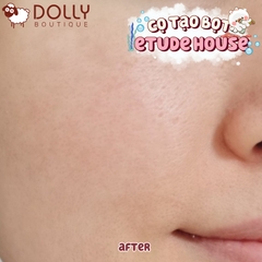 Cọ Rửa Mặt Tạo Bọt Bạch Tuộc Etude House My Beauty Tool Jellyfish Silicon