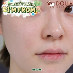 Tinh Chất Dưỡng Ẩm Chiết Xuất Ngải Cứu I'm From Mugwort Essence 160ml NK