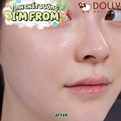 Tinh Chất Dưỡng Ẩm Chiết Xuất Ngải Cứu I'm From Mugwort Essence 160ml NK