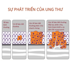 Ung thư là gì?