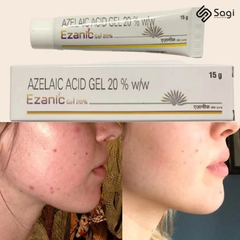 Gel Trị Mụn Giảm Thâm Ezanic Gel 20% Azelaic Acid