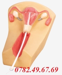 MÔ HÌNH THỰC HÀNH ĐẶT VÒNG TRÁNH THAI