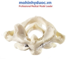Mô hình đốt sống cổ thứ nhất và thứ hai (Atlas và trục) SOMSO