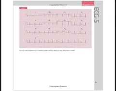 Sách ngoại văn 150 ECG Cases 5th