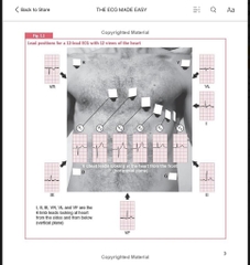 Sách ngoại văn The ECG Made Easy 9th