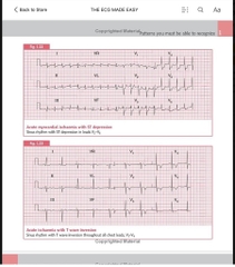 Sách ngoại văn The ECG Made Easy 9th